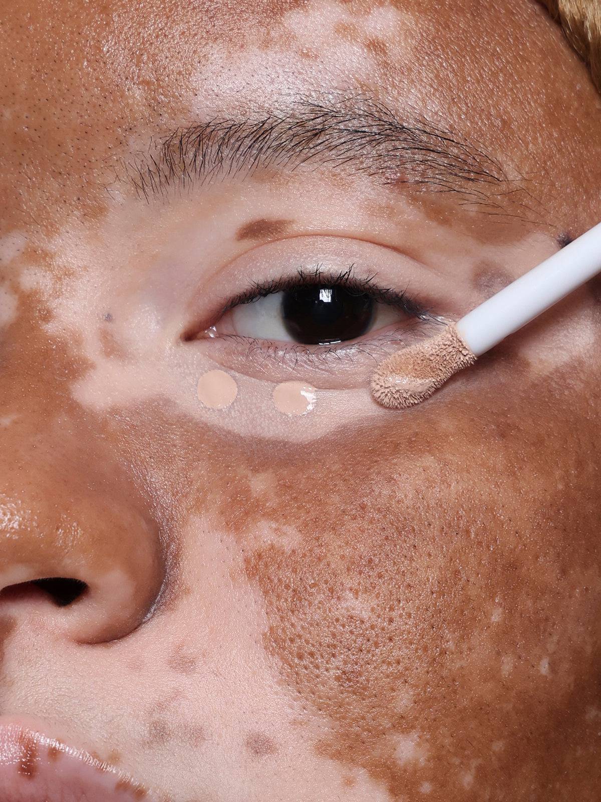 Refy Concealer - Kapatıcı - stre