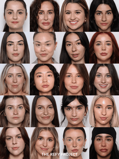 Refy Concealer - Kapatıcı - stre