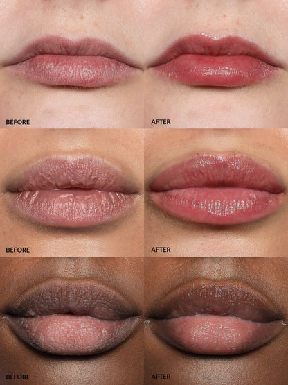 Refy Lip Buff - Dudak Dolgunlaştırıcı - stre